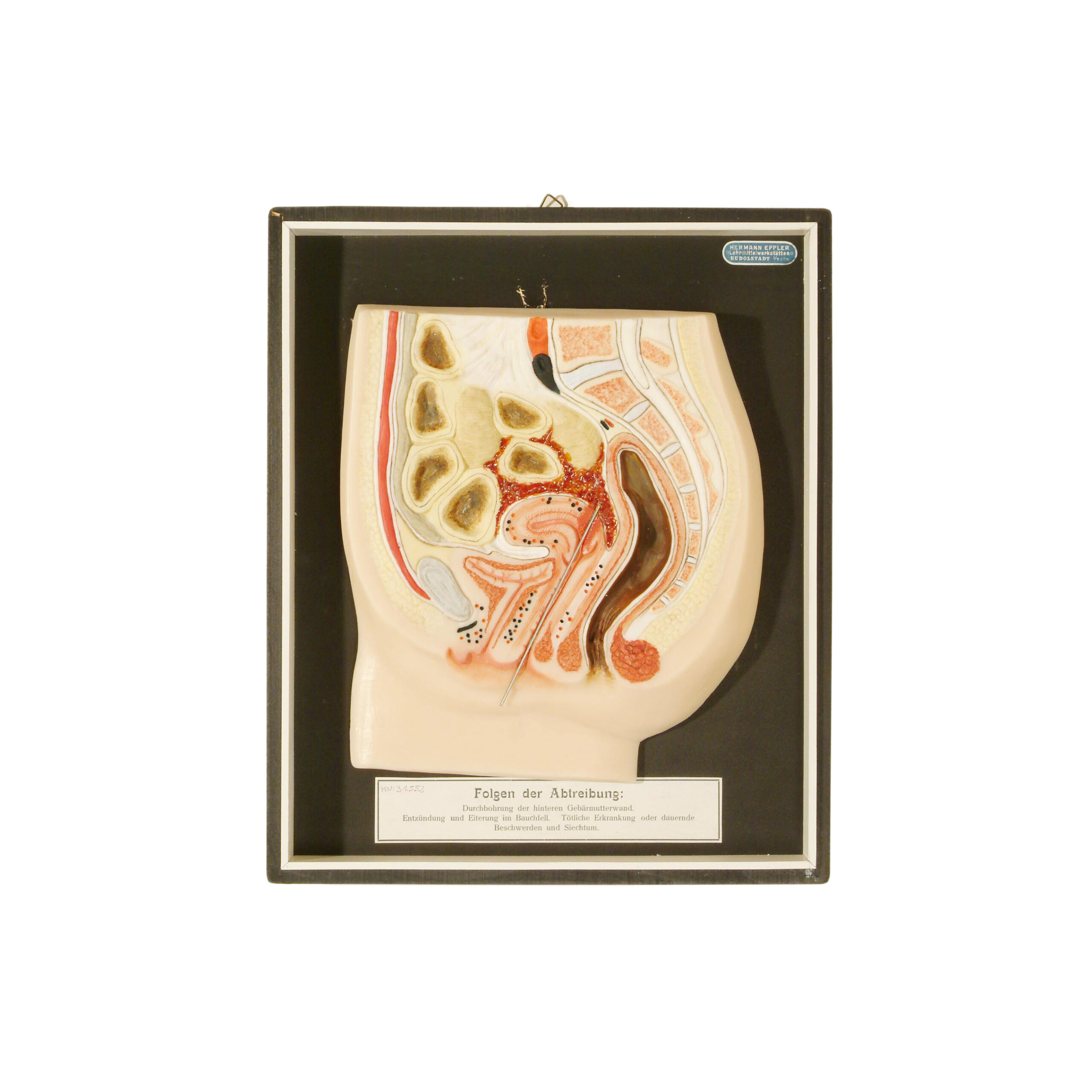 Die Stricknadel als Abtreibungsinstrument: Was ein Küchengegenstand über die Illegalität von Schwangerschaftsabbrüchen erzählt