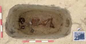Bioarchäologie: Was Knochen über Krankheit, Arbeit und das Ende vom Mythos „früher war alles besser“ erzählen