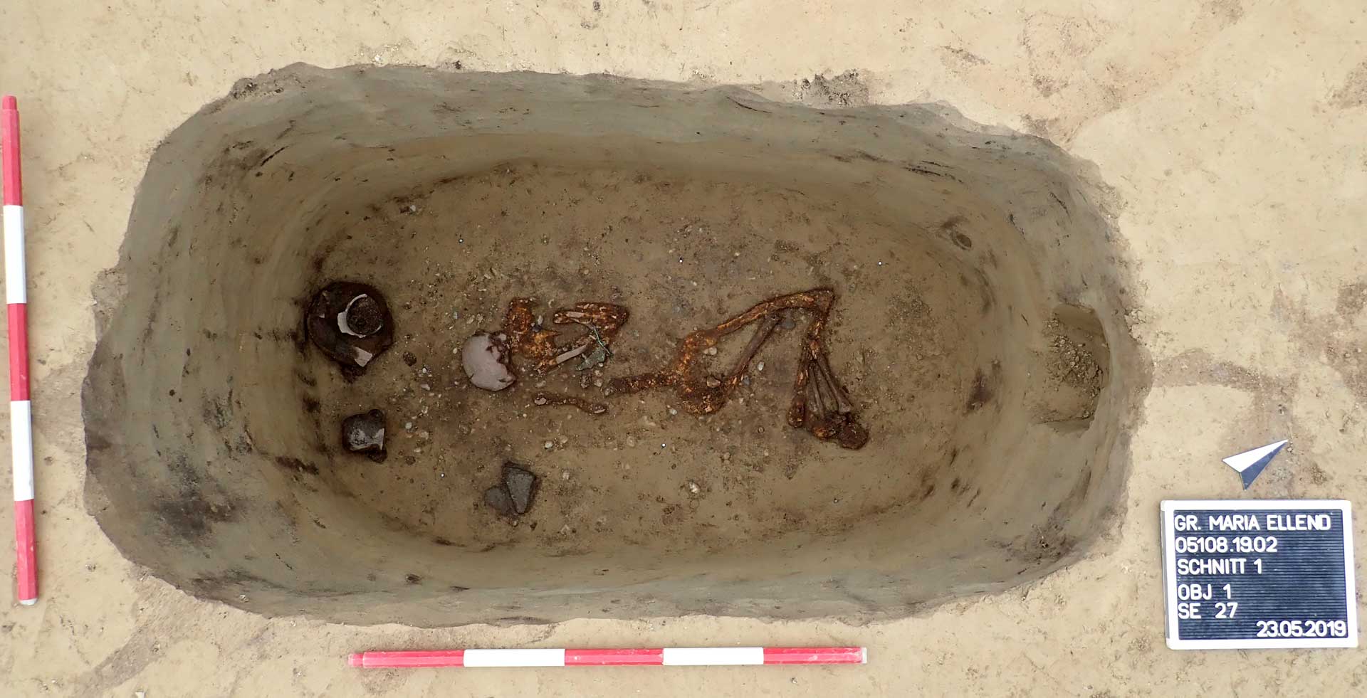 Bioarchäologie: Was Knochen über Krankheit, Arbeit und das Ende vom Mythos „früher war alles besser“ erzählen
